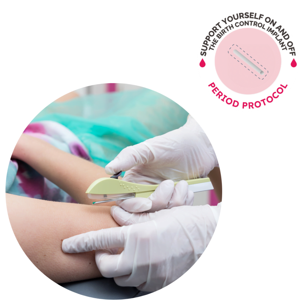 Support Yourself On and Off the Birth Control Implant HERO Image